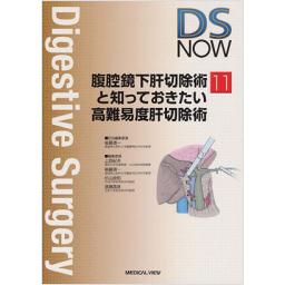 DS　NOW　No.11　腹腔鏡下肝切除術と知っておきたい高難易度肝切除術