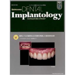 Quintessence DENTAL Implantology　18/5　2011年