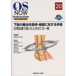 OS　NOW　Instruction　No.20　下肢の難治性骨折・病態に対する手術