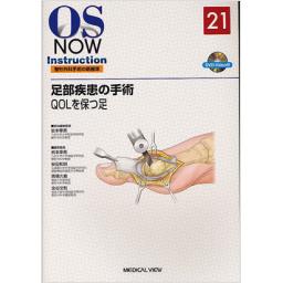 OS　NOW　Instruction　No.21　足部疾患の手術
