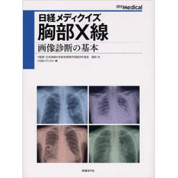日経メディクイズ　胸部X線　画像診断の基本