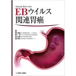 EBウイルス関連胃癌