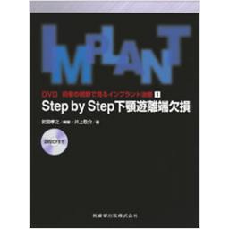 Step　by　Step　下顎遊離端欠損