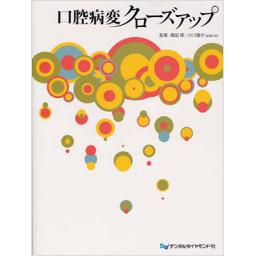口腔病変クローズアップ
