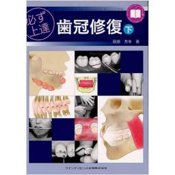 必ず上達　歯冠修復　【下】