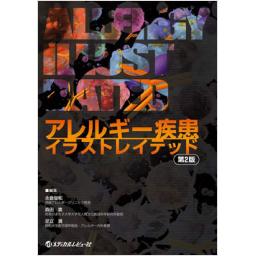 アレルギー疾患イラストレイテッド　第2版