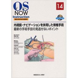 OS　NOW　Instruction　No.14　内視鏡・ナビゲーションを併用した脊椎手術