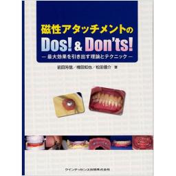 磁性アタッチメントのDos!　&　Don'ts!