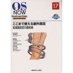 OS　NOW　Instruction　No.17　ここまで使える創外固定