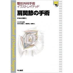 整形外科手術イラストレイテッド　肩関節の手術