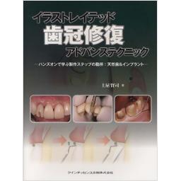 イラストレイテッド　歯冠修復　アドバンステクニック
