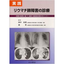 実践　リウマチ肺障害の診療