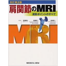 肩関節のMRI　改訂第2版