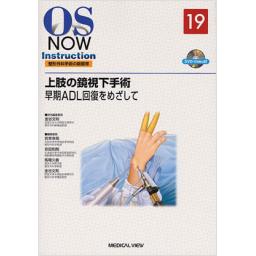 OS　NOW　Instruction　No.19　上肢の鏡視下手術