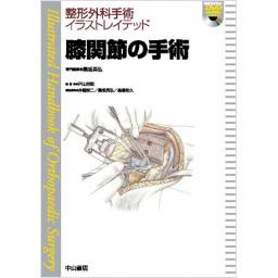 整形外科手術イラストレイテッド　膝関節の手術