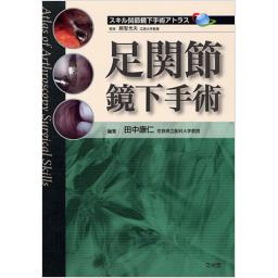 足関節鏡下手術