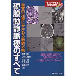硬膜動静脈瘻のすべて