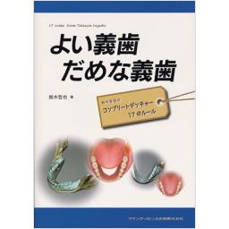 よい義歯　だめな義歯
