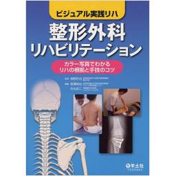 整形外科リハビリテーション