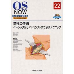 OS　NOW　Instruction　No.22　頚椎の手術