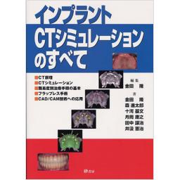 インプラントCTシミュレーションのすべて