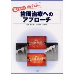 歯周治療へのアプローチ