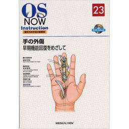 OS　NOW　Instruction　No.23　手の外傷　早期機能回復をめざして