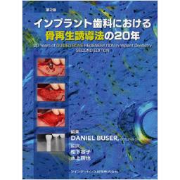 インプラント歯科における骨再生誘導法の20年　第2版