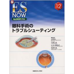 新ES　NOW　No.12　眼科手術のトラブルシューティング