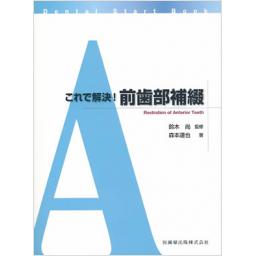 これで解決!　前歯部補綴