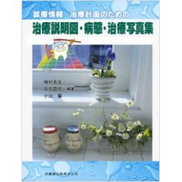 診療情報・治療計画のための治療説明図・病態・治療写真集