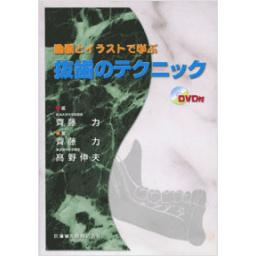 動画とイラストで学ぶ　抜歯のテクニック