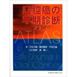 口腔癌の早期診断アトラス