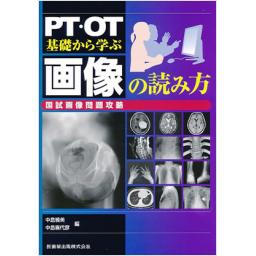 PT・OT　基礎から学ぶ　画像の読み方　国試画像問題攻略