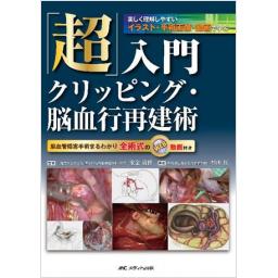 「超」入門クリッピング・脳血行再建術