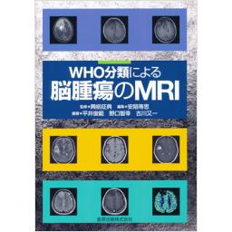 WHO分類による脳腫瘍のMRI
