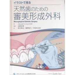 イラストで見る　天然歯のための審美形成外科