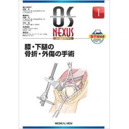 OS NEXUS　No.1　膝・下腿の骨折・外傷の手術