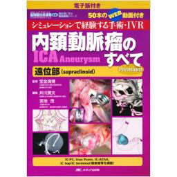 電子版付き　内頚動脈瘤(ICA　Aneurysm)のすべて　遠位部(supraclinoid)