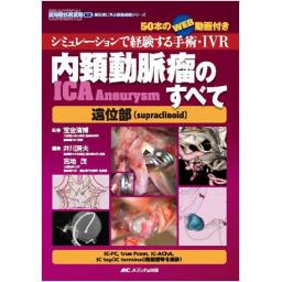 内頚動脈瘤(ICA　Aneurysm)のすべて　遠位部(supraclinoid)