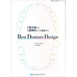 1歯欠損から1歯残存までを補綴する　Best Denture Design