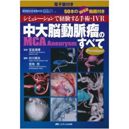 電子版付き　中大脳動脈瘤(MCA　Aneurysm)のすべて