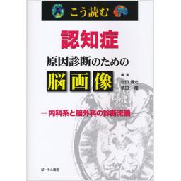 こう読む　認知症　原因診断のための脳画像