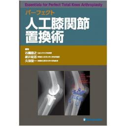 パーフェクト　人工膝関節置換術