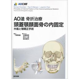 AO法骨折治療　頭蓋顎顔面骨の内固定