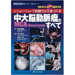 中大脳動脈瘤(MCA Aneurysm)のすべて ―シミュレーションで経験する手術・IVR 50本のWEB動画付き