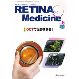 RETINA Medicine　6/2　2017年秋号