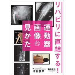 リハビリに直結する！　運動器画像の見かた