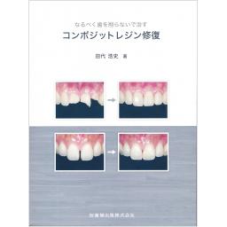 コンポジットレジン修復