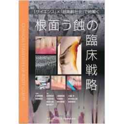 根面う蝕の臨床戦略
